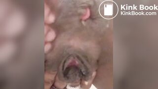 Black ebony brown eye got pink eye (end)