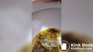 Girl Lactose Intolerance Diarrhea