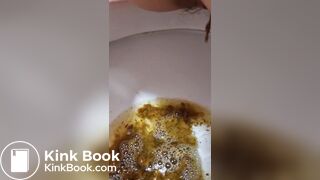 Girl Lactose Intolerance Diarrhea