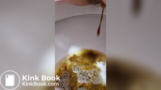 Girl Lactose Intolerance Diarrhea