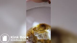 Girl Lactose Intolerance Diarrhea