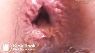 Incredible monster poop 11