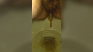 Ruining The Toilet Bowl With My Urgent Diarrhea ♡