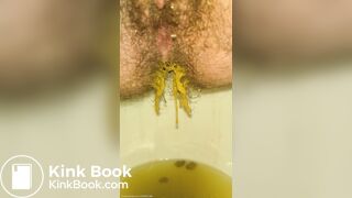 Ruining The Toilet Bowl With My Urgent Diarrhea ♡