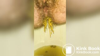 Ruining The Toilet Bowl With My Urgent Diarrhea ♡