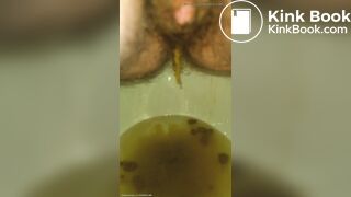 Ruining The Toilet Bowl With My Urgent Diarrhea ♡