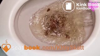 Extreme toilet clogging