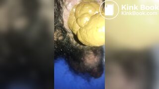 Huge poop coming out of my hairy ass