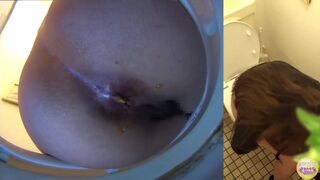 Diarrhea with no toilet paper after poop