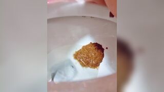 Explosive diarrhea - video 27