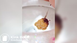 Explosive diarrhea - video 27