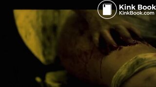 Septic man diarrhea and vomit