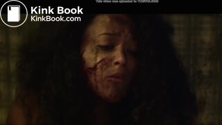 Septic man diarrhea and vomit