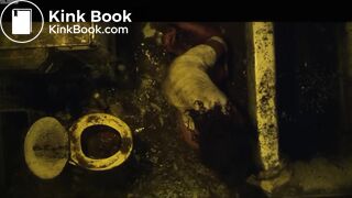 Septic man diarrhea and vomit