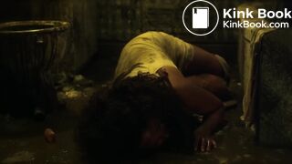 Septic man diarrhea and vomit