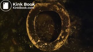 Septic man diarrhea and vomit