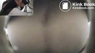 Classic constipation (multiple view)