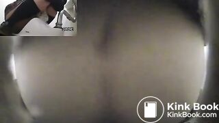 Classic constipation (multiple view)