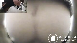 Classic constipation (multiple view)