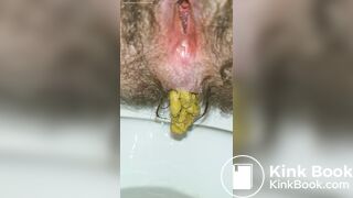 Pushing Out A Thick Turd