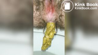 Pushing Out A Thick Turd