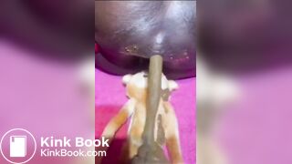 Girls having diarrea