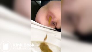 Girls having diarrea