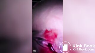spy camera asian girl pee and shit.video_170