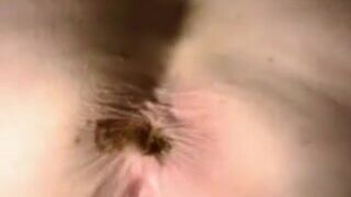 Old Alice Vid Pooping Complication