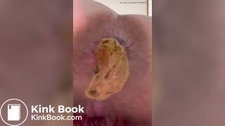 Japanese Twitter girl Poop on the camera