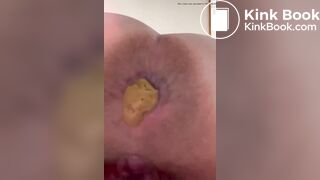 Japanese Twitter girl Poop on the camera