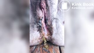 flies in dirty smelly pussy