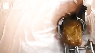 Rare scat sex and eat (UNCENSORED)