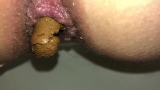 Compilation hairy and dirty assholes shitting