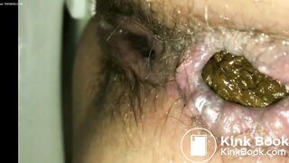 Compilation hairy and dirty assholes shitting