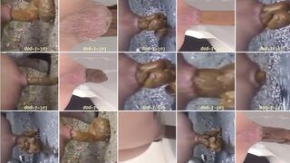 Amazing Distended Assholes ! - video 7