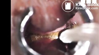 A view inside her butthole while pooping..