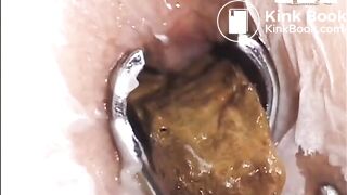 A view inside her butthole while pooping..