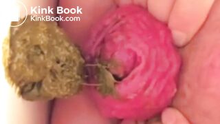 real prolapse girl pooping