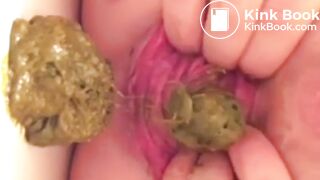 real prolapse girl pooping