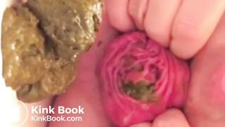 real prolapse girl pooping