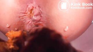 Another Anal Closeup Shitting 2