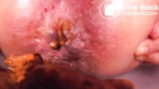 Another Anal Closeup Shitting 2