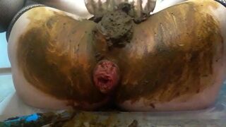 Prolapsed scat..