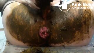Prolapsed scat..