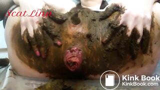 Prolapsed scat..