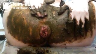 Prolapsed scat..