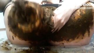 Prolapsed scat..