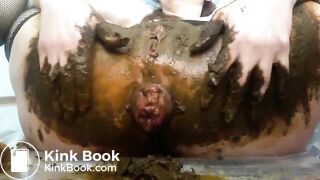 Prolapsed scat..
