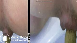 Amazing Distended Assholes - video 3